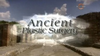 Пластическая хирургия в древности / Ancient Plastic Surgery (2004)