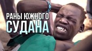 Раны Южного Судана (2020)