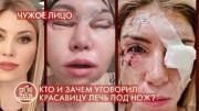 Кто и зачем уговорил красавицу лечь под нож (13.08.2022)
